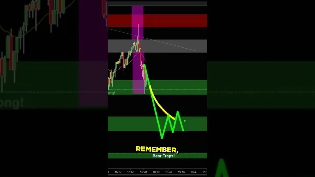 NEWS is Noise.. CHART is the Truth | Joseph James💰