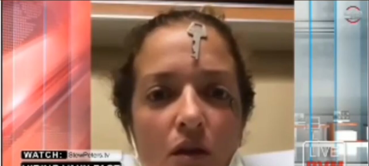 COSA CONTENGONO DI MAGNETICO PFIZER E MODE-RNA ?