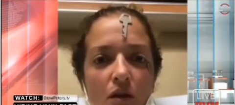 COSA CONTENGONO DI MAGNETICO PFIZER E MODE-RNA ?