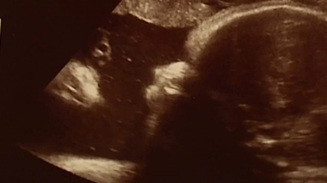 Couple sees Jesus in baby's sonogram