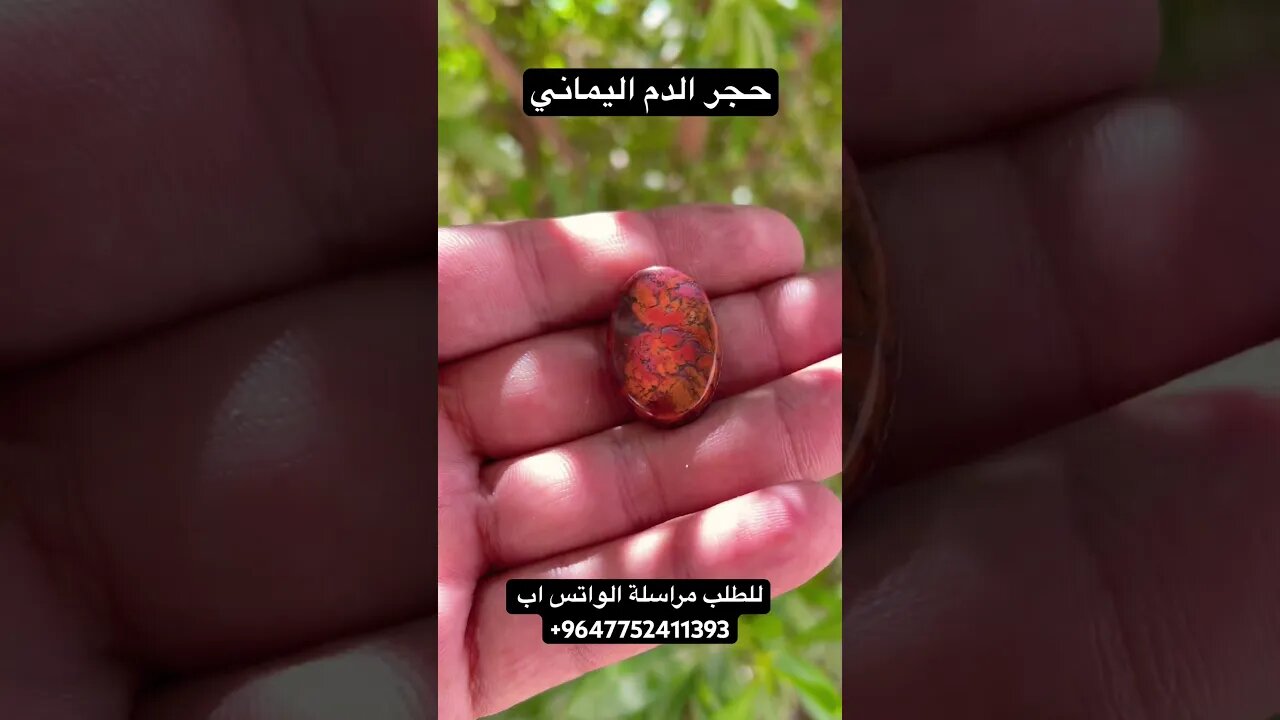 حجر الدم