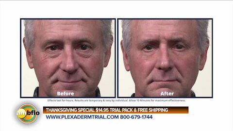 PLEXADERM - NOVEMBER 6