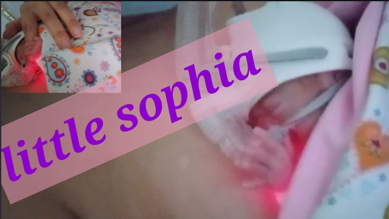 Baby sophia opens her eyes for the fhe first time