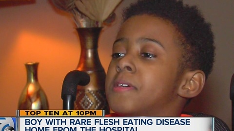 Detroit boy diagnosed with flesh-eating disease back home after amputation, months in the hospital