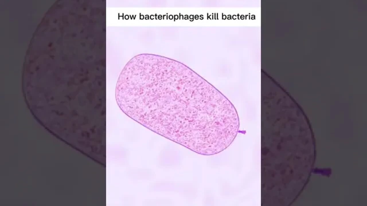 How does Bacteriophage kill Bacteria under microscope