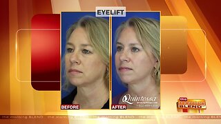 Clear Up Droopy Eyelids for a More Youthful Appearance