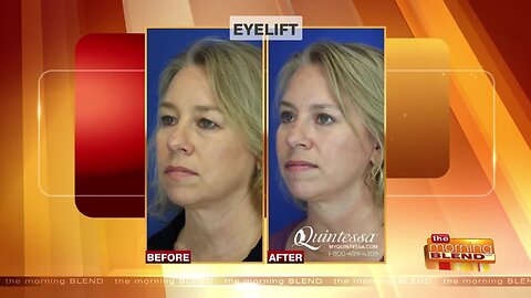 Clear Up Droopy Eyelids for a More Youthful Appearance