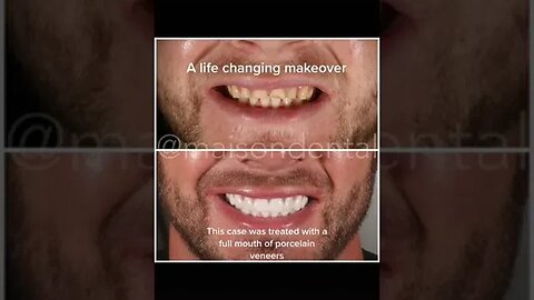 Dental And Teeth Hygiene