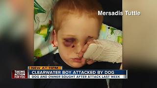Child, 3, in ICU after dog attack in Clearwater