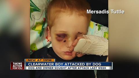 Child, 3, in ICU after dog attack in Clearwater