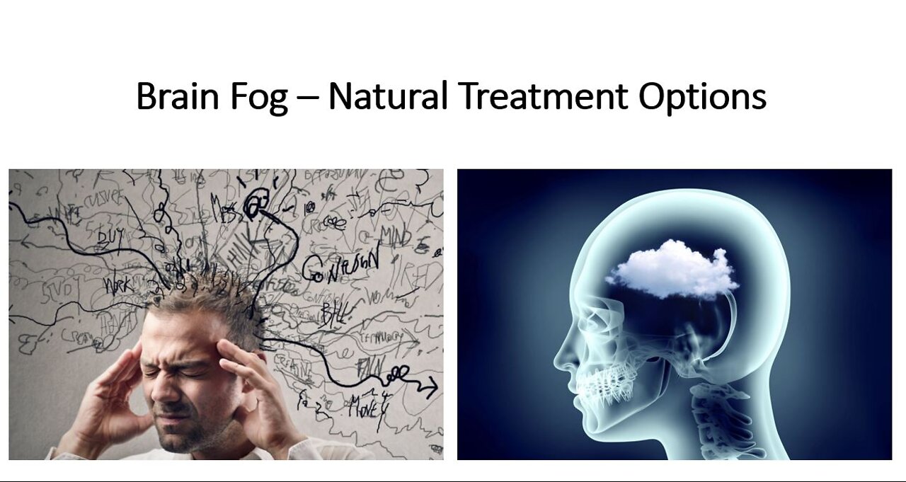 Brain Fog - Causes & Natural Treatment Options