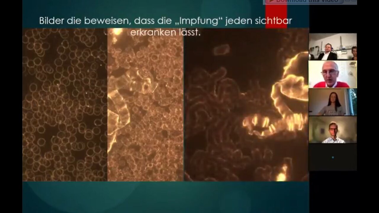 Undeclared ⁣deadly C-19 vaxx particles reported by German scientists