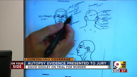 Autopsy evidence presented to jury