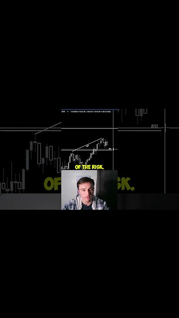Get Over The Mindset Of Scared To Lose In Day Trading #daytrading #stocks #forex #shorts #viral