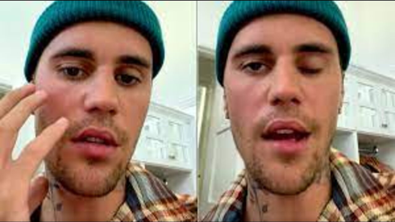 Justin Bieber Is Going To Die Because Of His Eye 👀