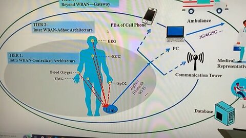 Body Part On Video Game Controller - Your Ass Hooked To The Cloud! Psinergy