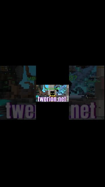 How to practice speedbridging !!!!