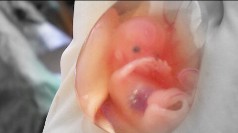 ABOMINATION: How HEK Fetal Cell Line Was Created