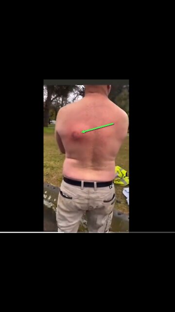 COMMISTRALIA: What does it feel like to be shot?