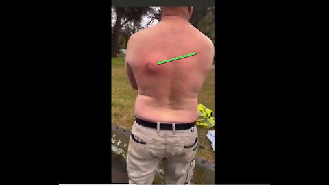 COMMISTRALIA: What does it feel like to be shot?