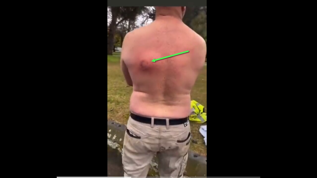 COMMISTRALIA: What does it feel like to be shot?