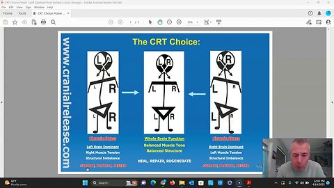 Cranial Release Technique (CRT) - The CRT Choice