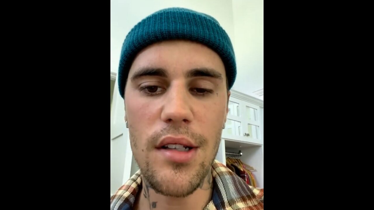 BREAKING! SHINGLES HAVE GIVEN JUSTIN BEIBER FACE PARALYSIS!!