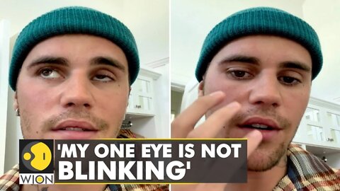 Justin Bieber reveals facial paralysis, pauses his World tour | International News | WION
