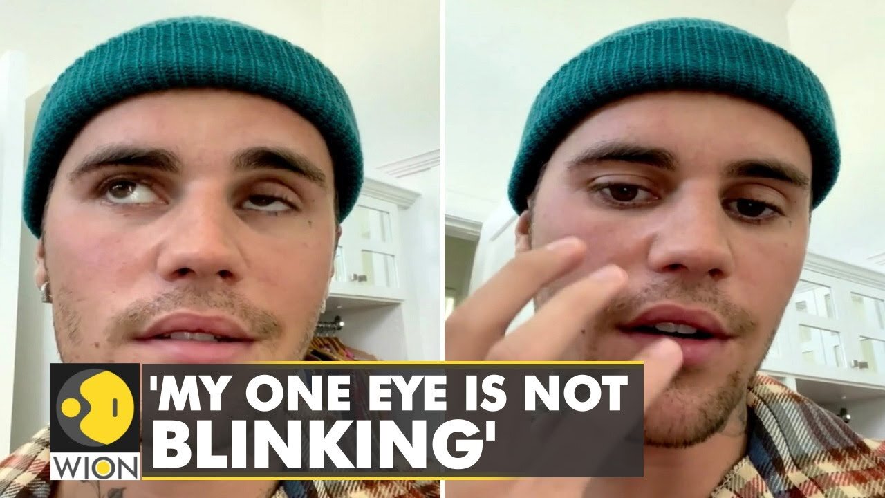 Justin Bieber reveals facial paralysis, pauses his World tour | International News | WION