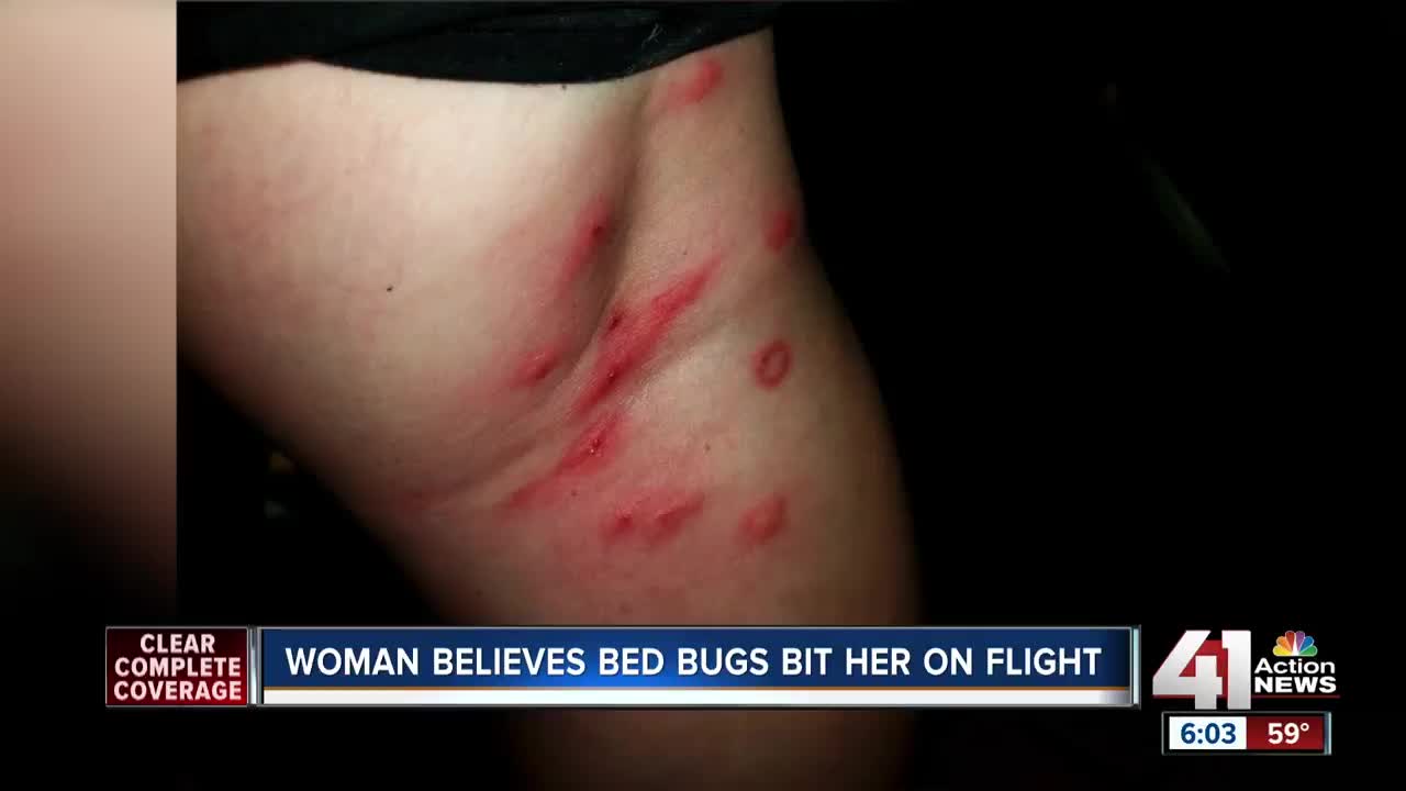 Woman says she was bitten by bugs during flight