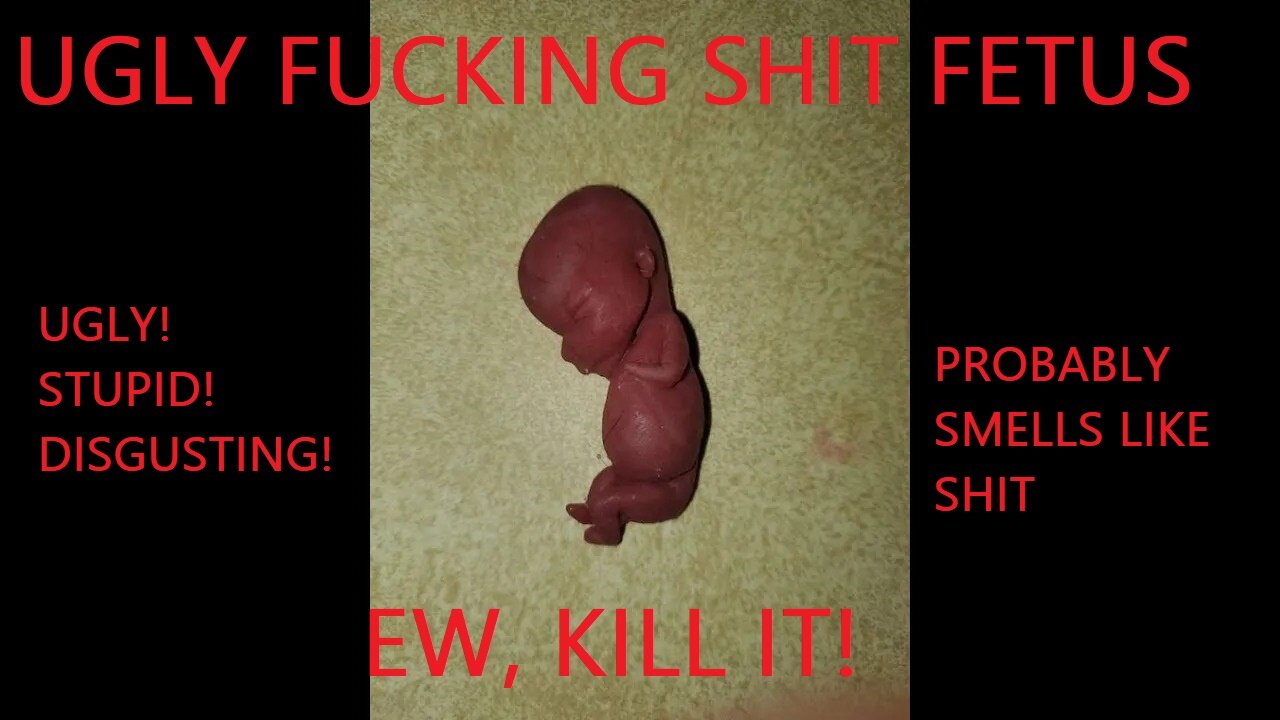 I rented a LIVE FETUS from a shady abortion doctor for $50 and KICKED IT OFF MY ROOF b/c I was bored