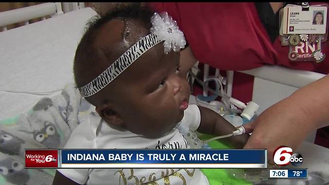 Premature miracle baby released from Riley Children's Hospital