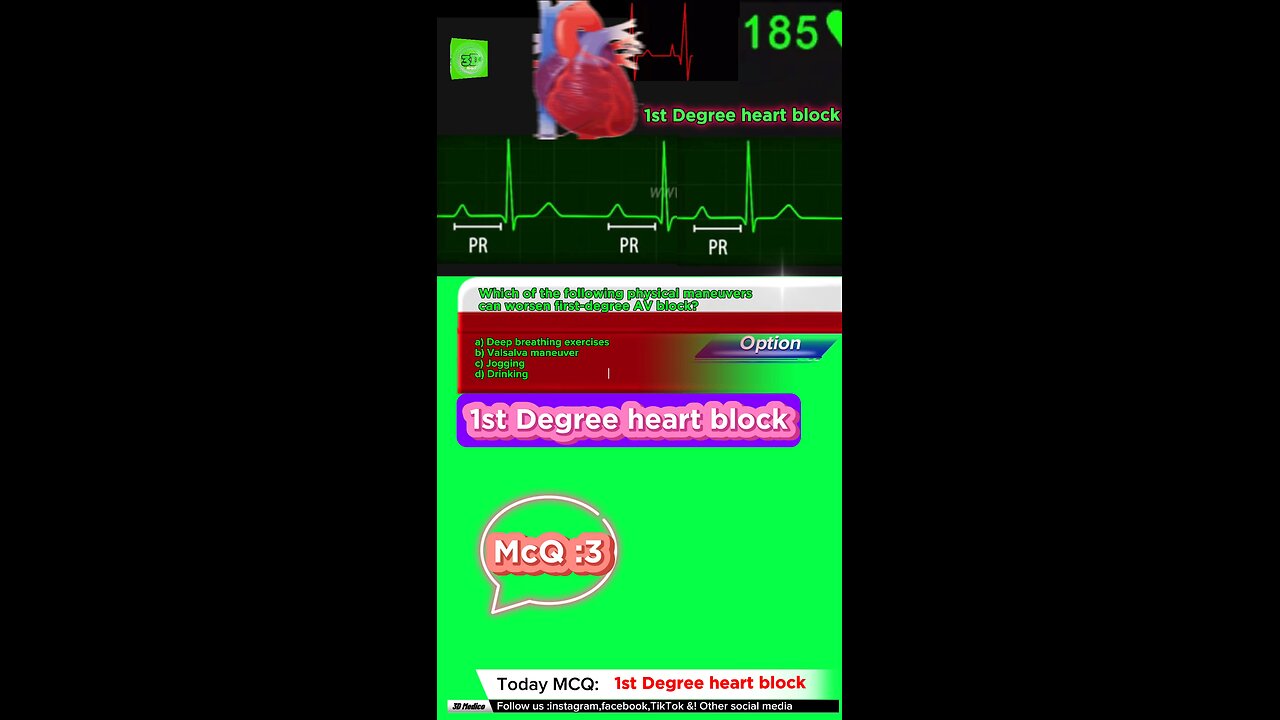 First degree heart blockages #firstdegreeavblock #arrthymias #CardiacArrhythmia #Cardiology