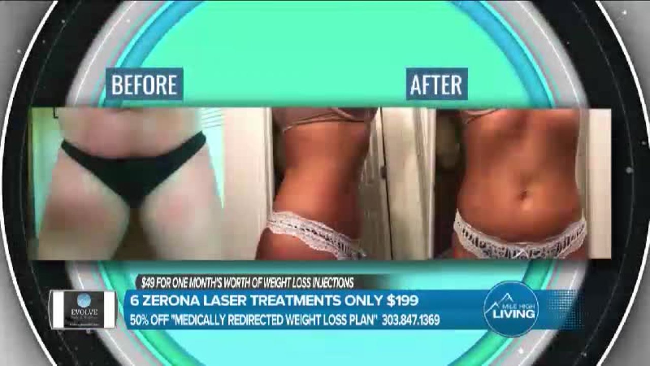 Evolve Body & Wellness - Lose Inches Fast