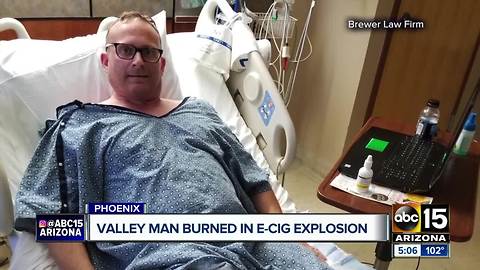 Man suffers burns after e-cigarette explodes