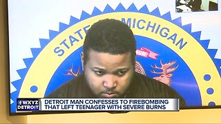 Detroit man confesses to firebombing that left teenager with severe burns