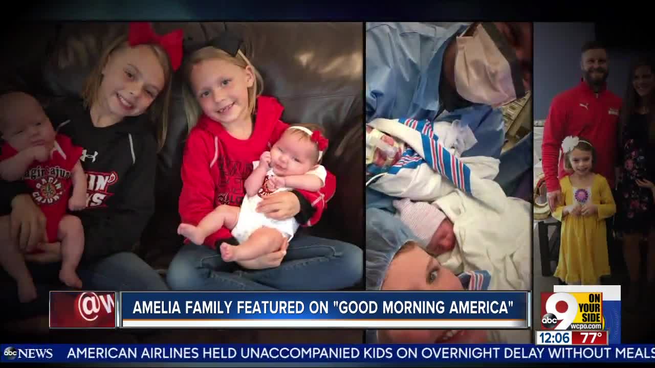 Amelia family featured on "Good Morning America"