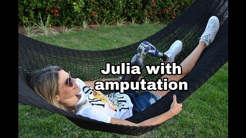 Julia after her legs were amputated