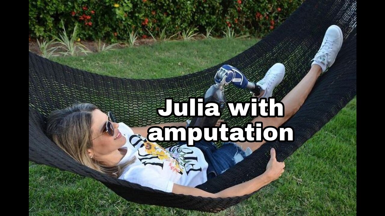 Julia after her legs were amputated