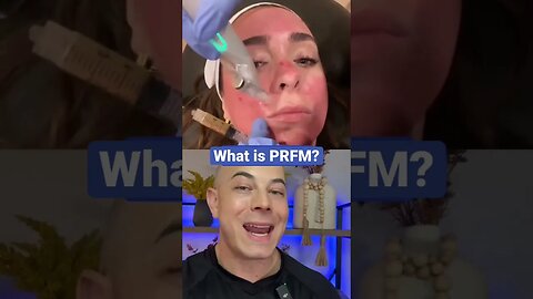 Doctor explains PRFM!!