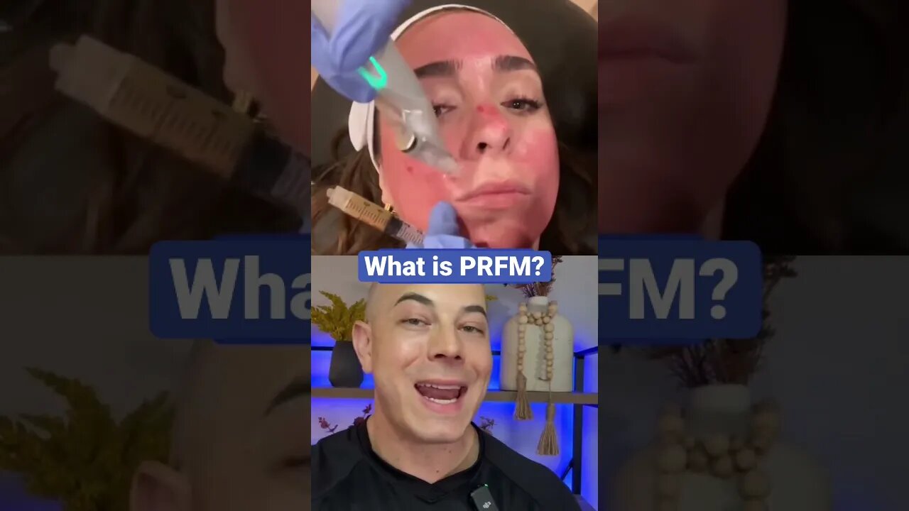 Doctor explains PRFM!!