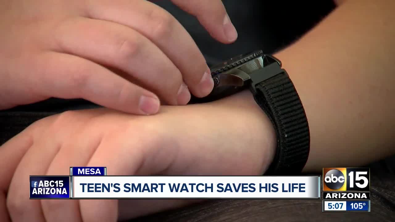 Family says smart watch helped save teen's life