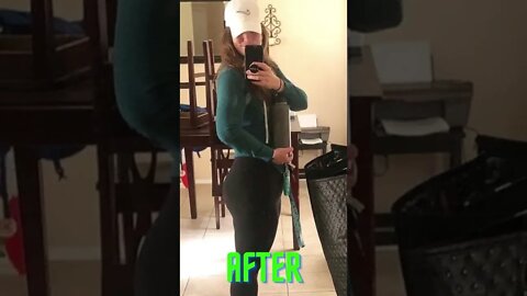 Amazing Keto Diet Before After Weight Loss Transformations #shorts #