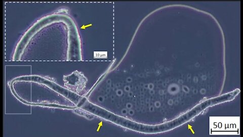 Pfizer "vaccine" microscope photos released by Dr.John B
