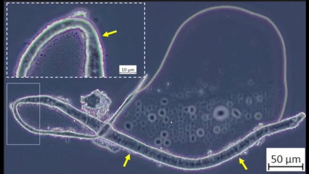 Pfizer "vaccine" microscope photos released by Dr.John B