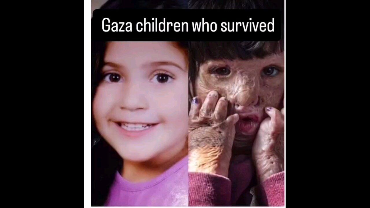 This is what israel does to Palestinian children!