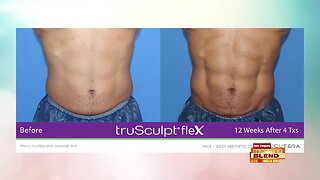 New Trends In Body Sculpting