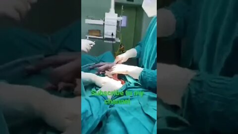 new baby born #shorts #shortsvideo #voiceofkanij