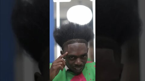 What’s With Lines On His Forehead? 🤣