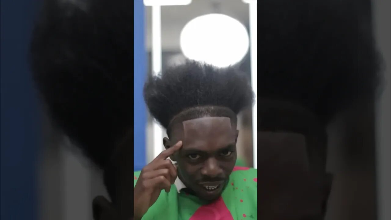 What’s With Lines On His Forehead? 🤣